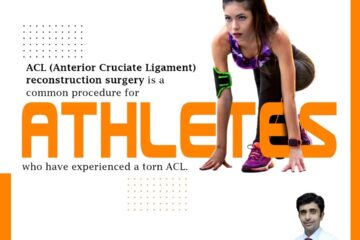 ACL reconstruction surgery